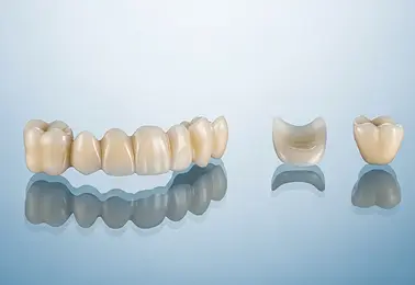 Mehrgliedrige Keramikbrücke in Produktansicht